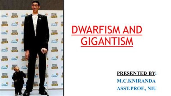 Exploring Danny Devito's Height And Dwarfism