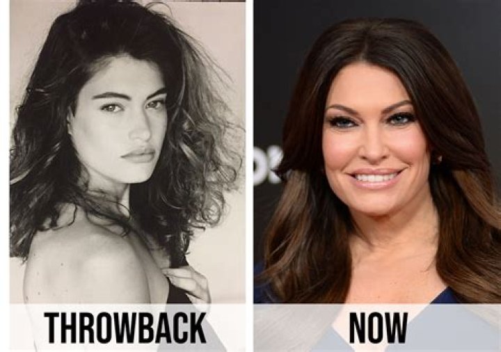 Kimberly Guilfoyle's Plastic Surgery Journey: Uncovering The Truth