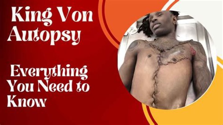 King Von's Autopsy Results: A Detailed Analysis
