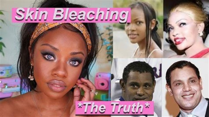 Nicki Minaj's Skin Bleaching Allegations And The Implications