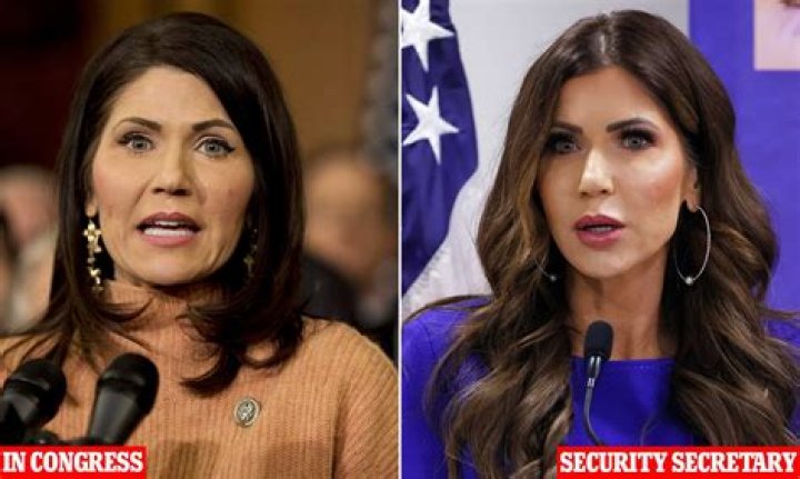 The Truth About Kristi Noem's Plastic Surgeries