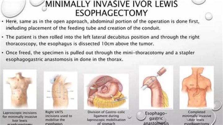 Unraveling The Life And Impact Of Ivor Morrison