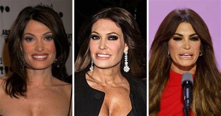 Unveiling The Truth: Has Kimberly Guilfoyle Had Cosmetic Surgery?