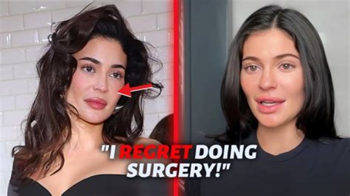 Zoe Saldana's Plastic Surgery Secrets Unmasked: Uncover The Surprising Truths